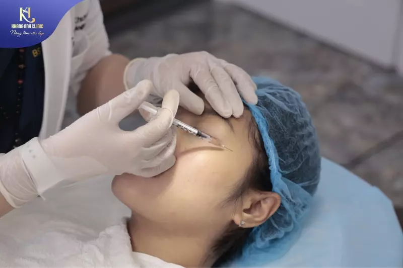 tiêm botox xóa nhăn mắt