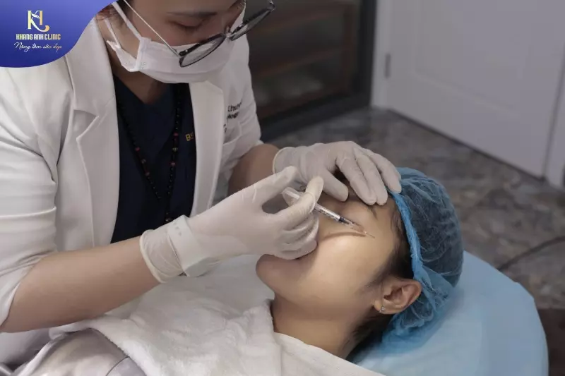 tiêm botox xóa nhăn mắt