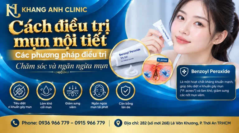 mụn nội tiết, trị mụn nội tiết, điều trị mụn nội tiết, cách điều trị mụn nội tiết