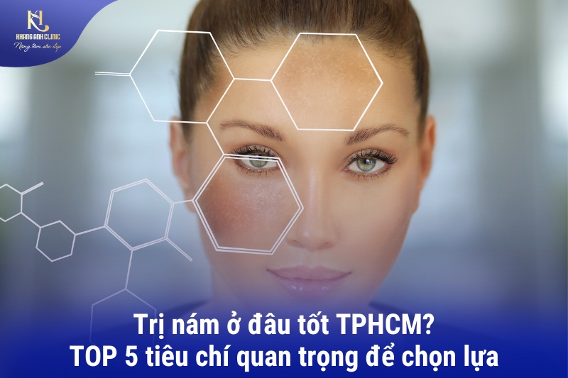 trị nám ở đâu tốt tphcm