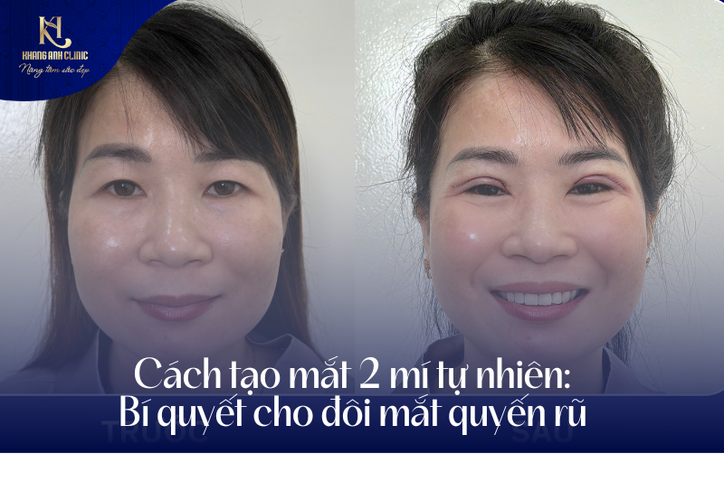 cách tạo mắt 2 mí tự nhiên