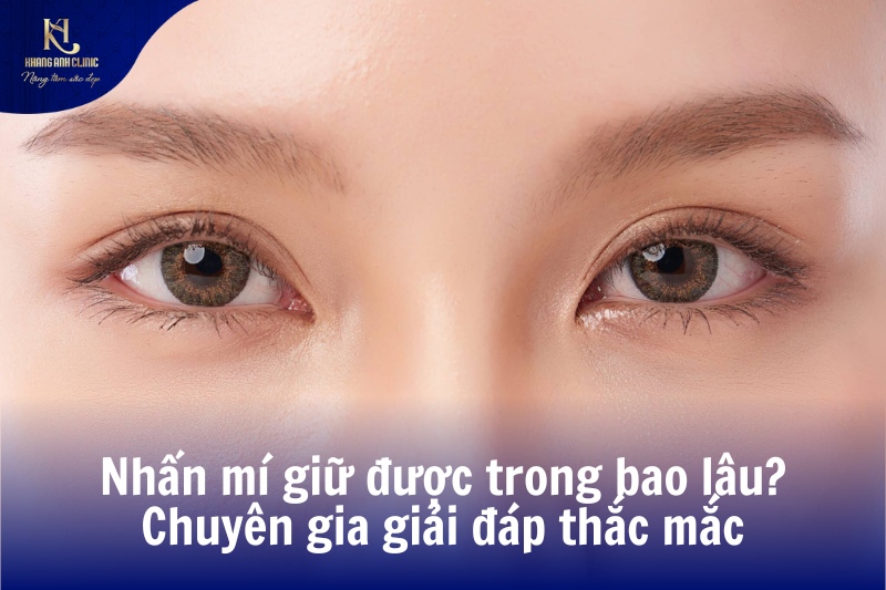 nhấn mí giữ được trong bao lâu