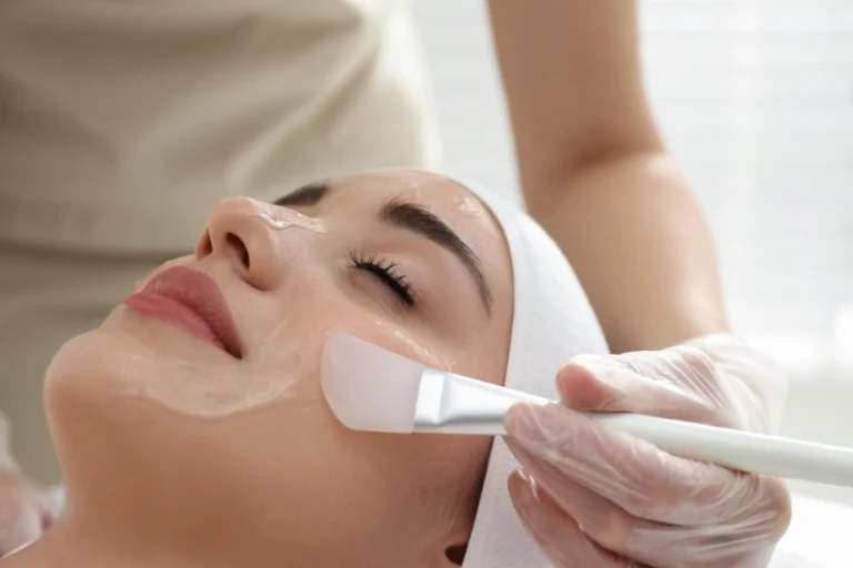 Cách chăm sóc da sau peel không bị kích ứng, da nhanh lành