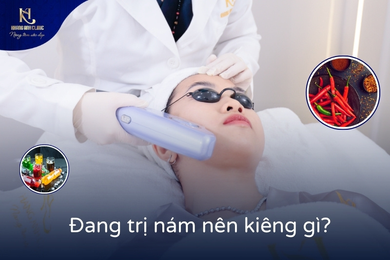 dang-tri-nam-nen-kieng-gi