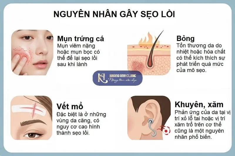 Vài nguyên nhân gây sẹo lồi phổ biến
