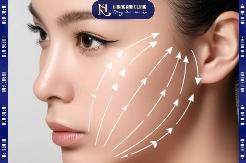 Căng da mặt tầng giữa SMAS