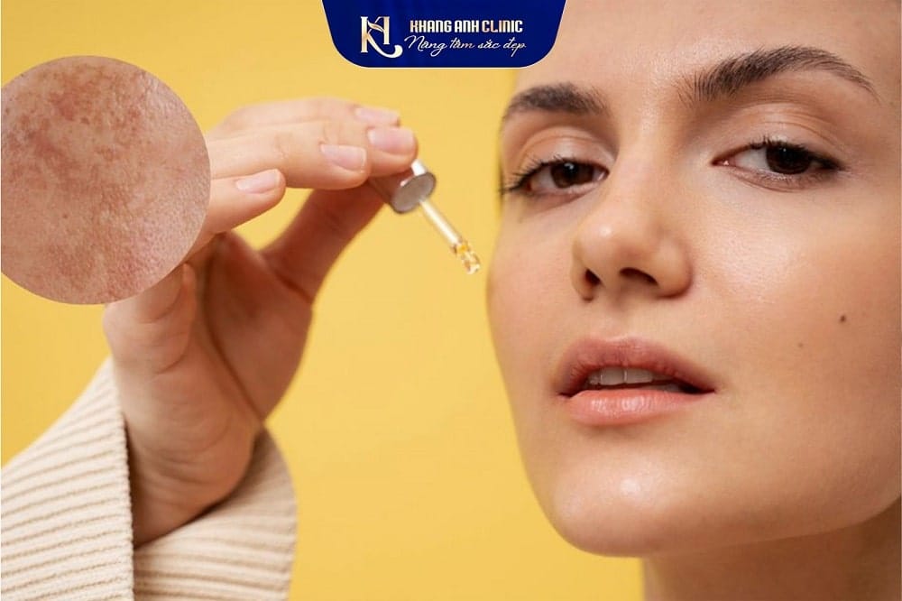 Chăm sóc da mặt sau trị nám mảng
