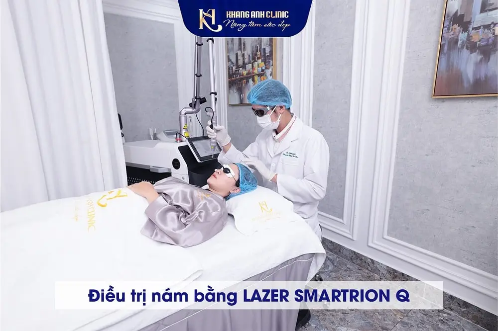 Điều trị nám mảng bằng laser
