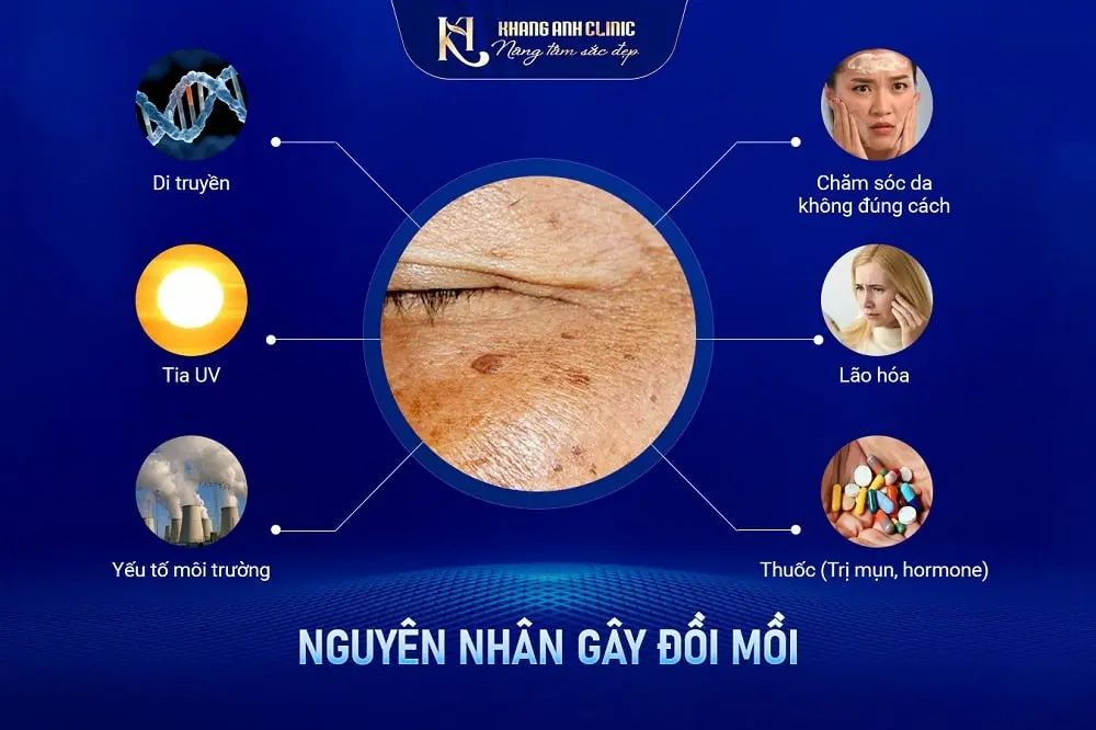 Những nguyên nhân gây đồi mồi trên da bạn cần biết