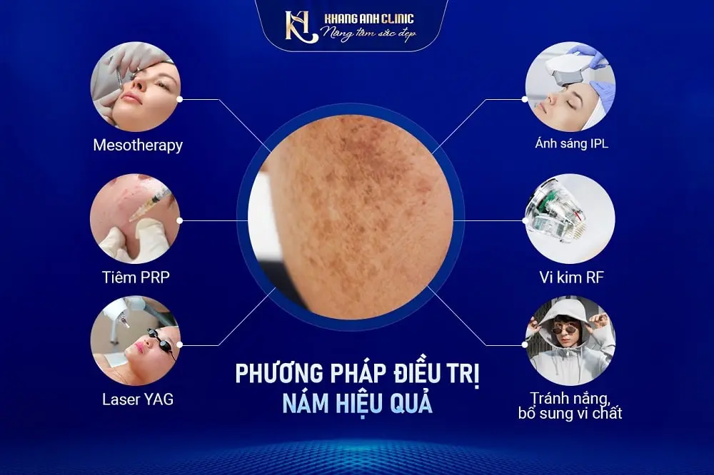 Các phương pháp trị nám hiệu quả