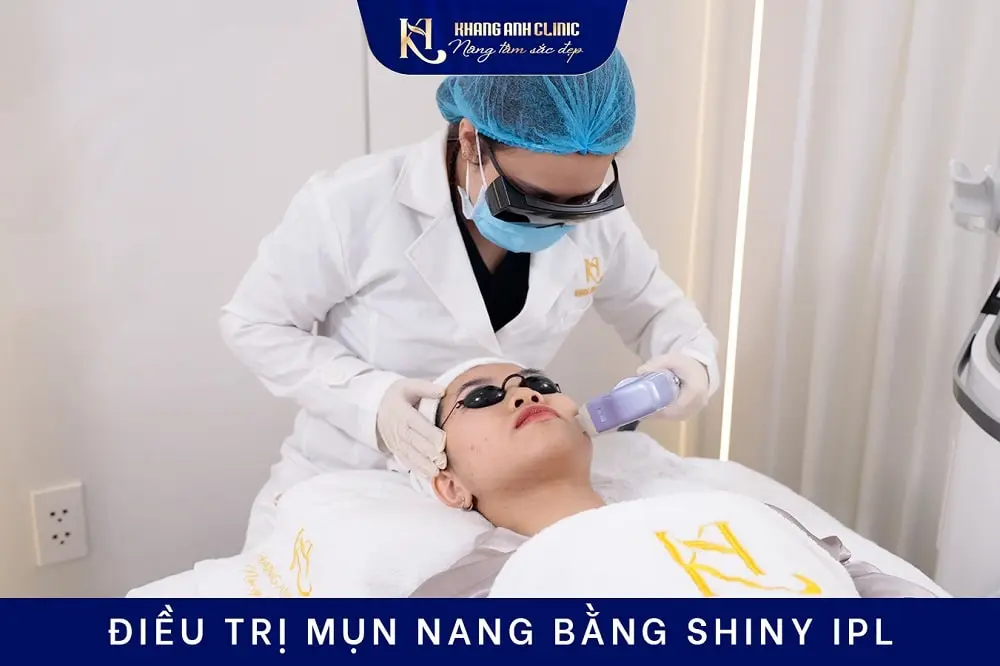 Bác sĩ trị mụn nang bằng Shiny IPL