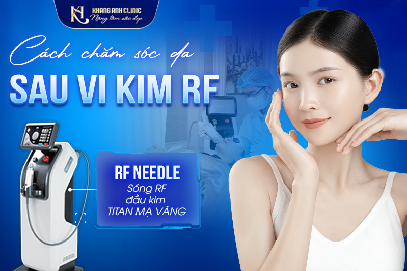 Chăm sóc da sau vi kim RF bạn cần biết