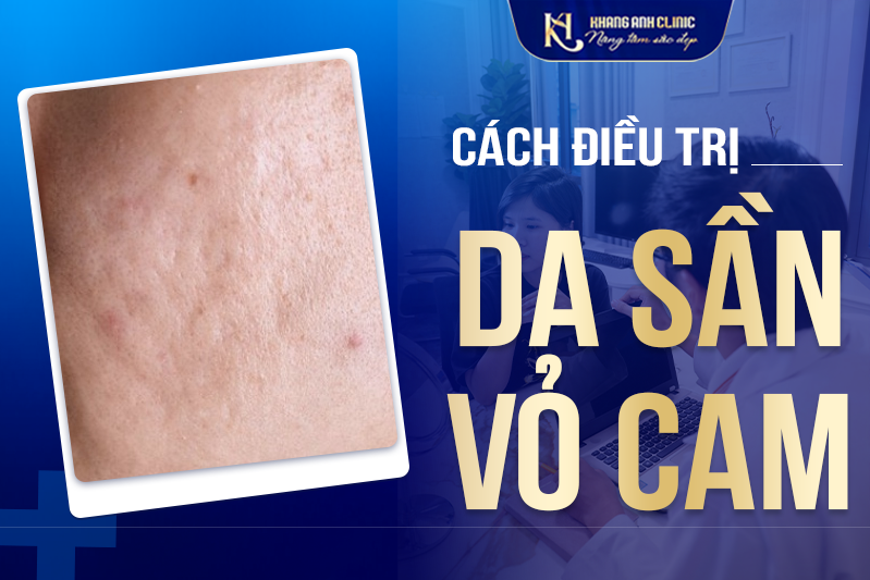 Cách điều trị da sần vỏ cam hiệu quả tại Khang Anh