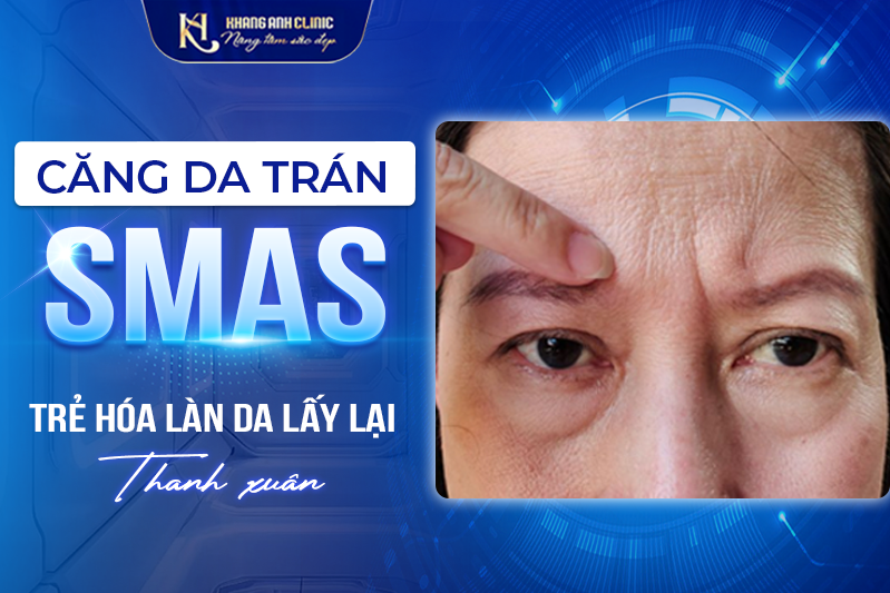 Căng da trán SMAS - Xóa hết Nếp nhăn, Trẻ hơn 10 tuổi