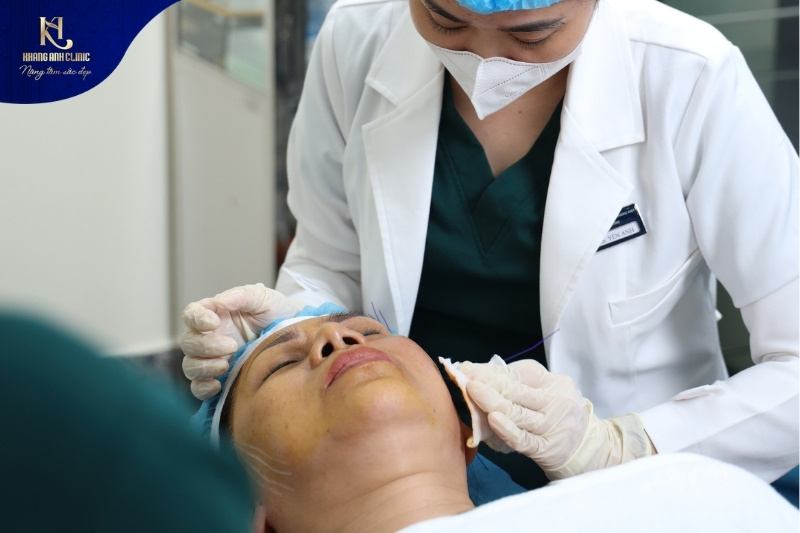 Phương pháp cắt mí dưới và căng da Midface phù hợp với chị em có nhu cầu trẻ hóa vùng mắt