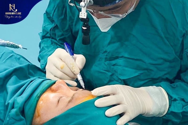 Bác sĩ chuyên khoa thẩm mỹ tại Phòng khám chuyên khoa thẩm mỹ Khang Anh thực hiện chuẩn Y khoa