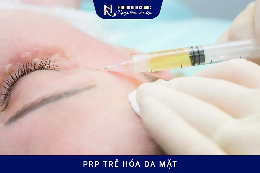 Cấy PRP trẻ hóa da mặt