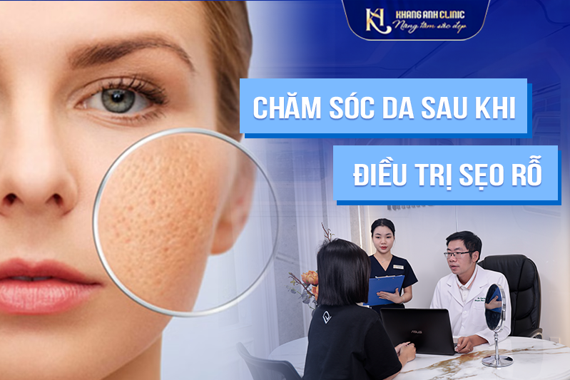 Một số cách chăm sóc da sau khi điều trị sẹo rỗ