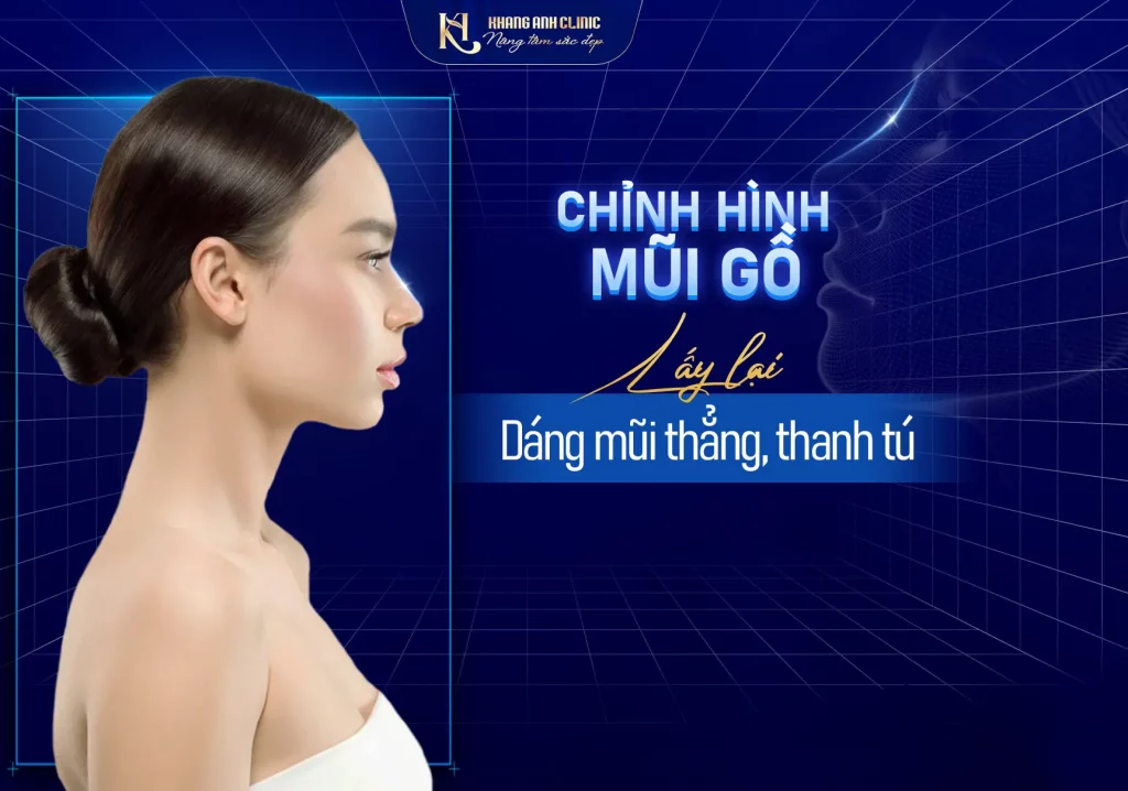 Chỉnh hình mũi gồ an toàn tại Khang Anh - Những điều bạn cần biết