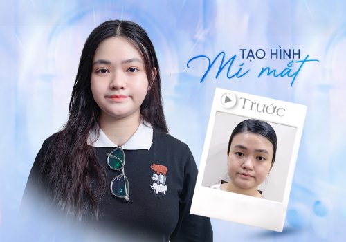 Feedback khách hàng nhấn mí tại Khang Anh