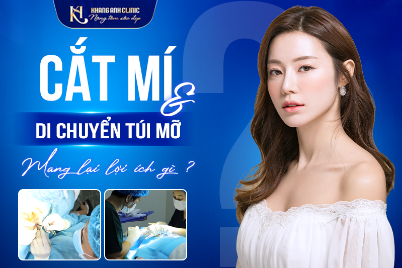 Những lợi ích khi cắt mí di chuyển túi mỡ tại Khang Anh
