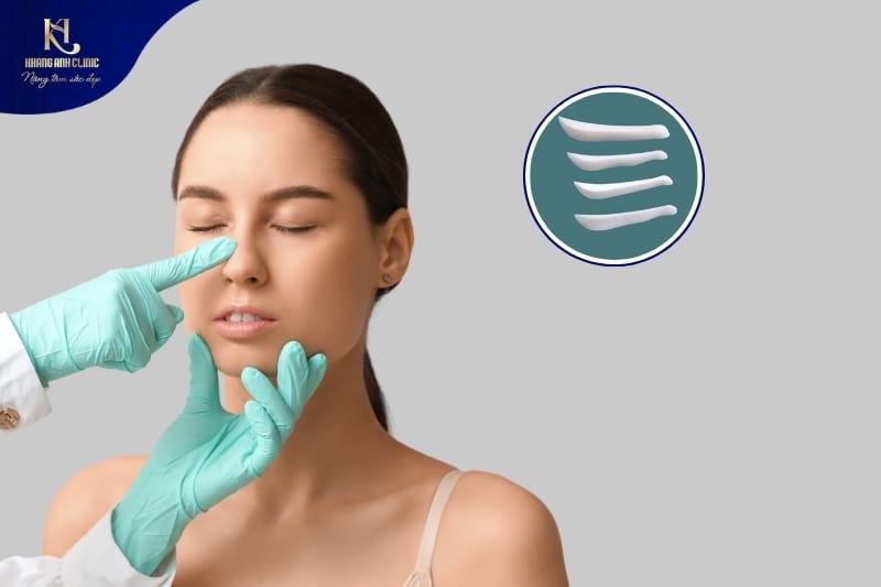 Nâng mũi sụn Surgiform tạo dáng mũi tự nhiên hạn chế