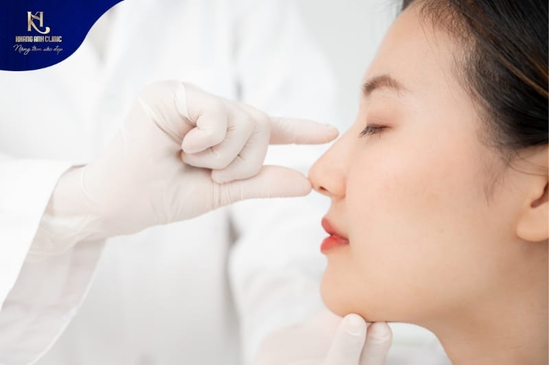 Sụn Surgiform nâng mũi có nguy cơ cao bị lộ, bóng đỏ đầu mũi
