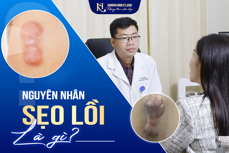 Một số nguyên nhân gây ra sẹo lồi phổ biến hiện nay