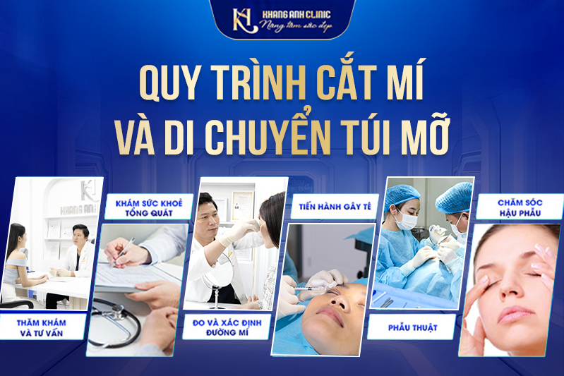 Quy trình cắt mí mắt và di chuyển túi mỡ chuẩn y khoa tại Khang Anh