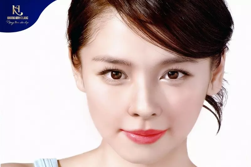 Mũi lệch là phần trụ mũi bị nghiêng, lệch, vẹo