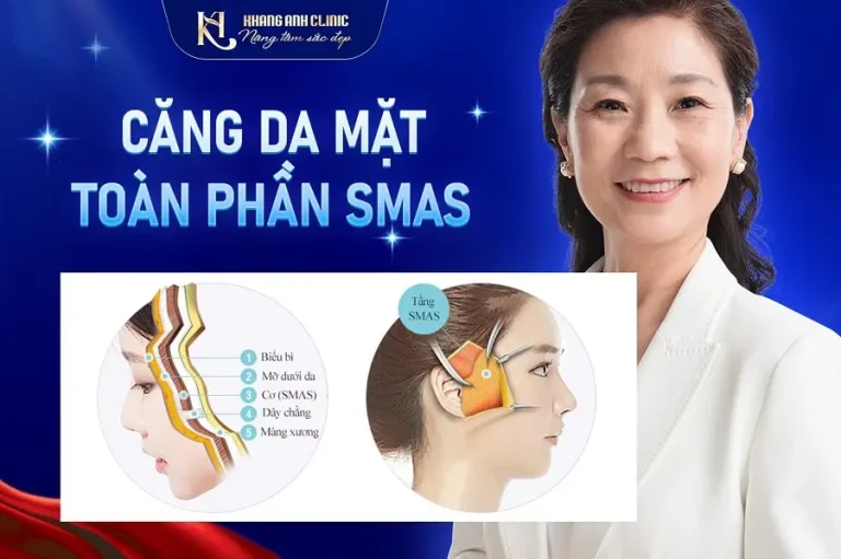 Thumb Căng da mặt toàn phần SMAS