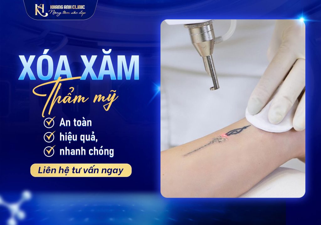 Xóa Xăm An Toàn, Không Sẹo - Công Nghệ Hiện Đại Tại Khang Anh