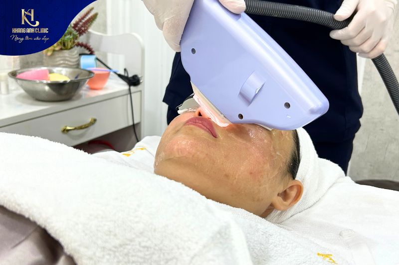 Liệu pháp điều trị mụn bằng công nghệ cao