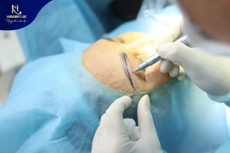 Dịch vụ tạo hình thẩm mỹ chuẩn Y khoa với bác sĩ CKI trực tiếp thực hiện