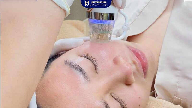 Cận Cảnh Đầu Kim TiTan Mạ Vàng máy RF Needle