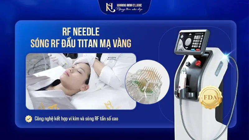 RF Needle là công nghệ kết hợp vi kim và sóng RF tần số cao