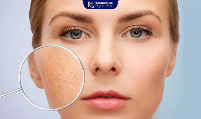 Điều Trị Sẹo Quận 12