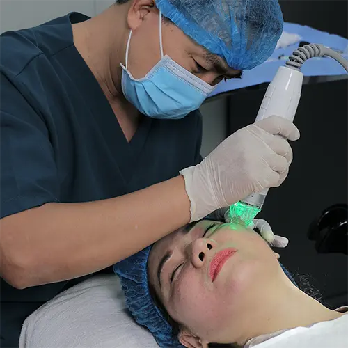 Công nghệ RF vi điểm
