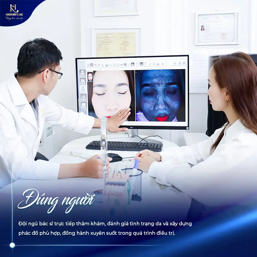 căng da mặt 3d, căng da mặt 3d là gì, căng da mặt