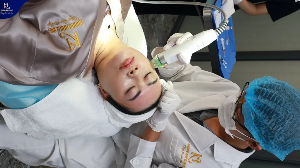 căng da mặt không phẫu thuật