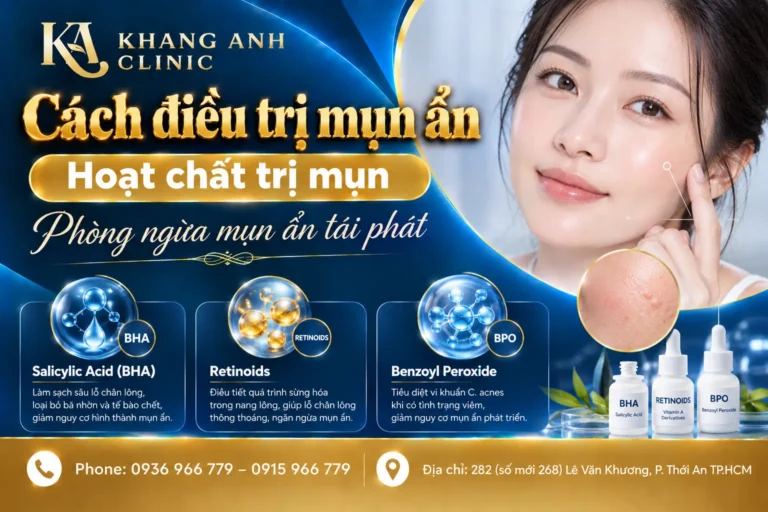 mụn ẩn, trị mụn ẩn, điều trị mụn ẩn, cách điều trị mụn ẩn
