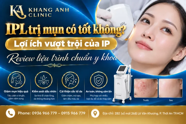 ipl trị mụn