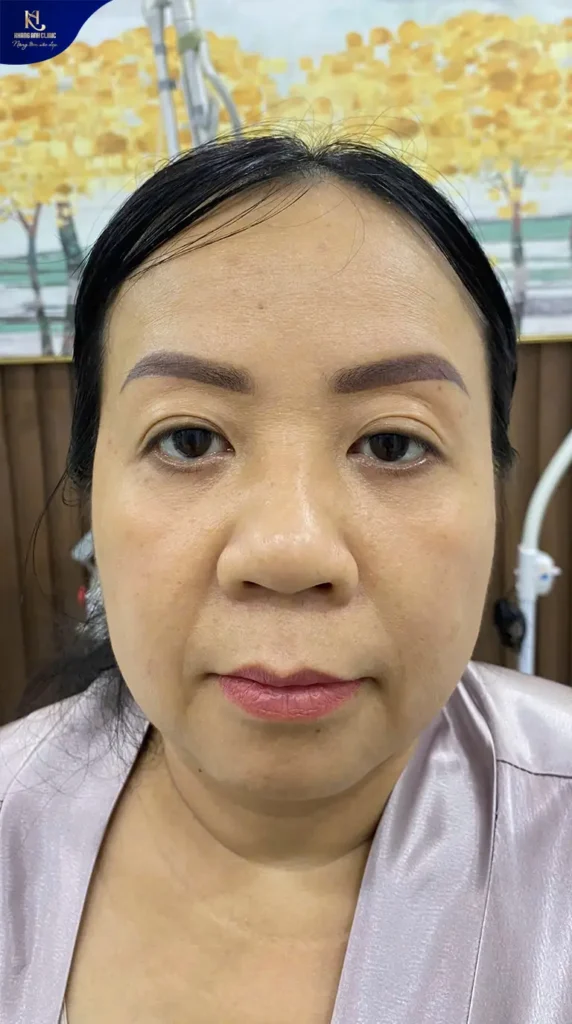 trẻ hoá da đa tầng, ăn gì để trẻ hóa làn da, trẻ hoá đa tầng là gì, chăm sóc da trẻ hoá đa tầng