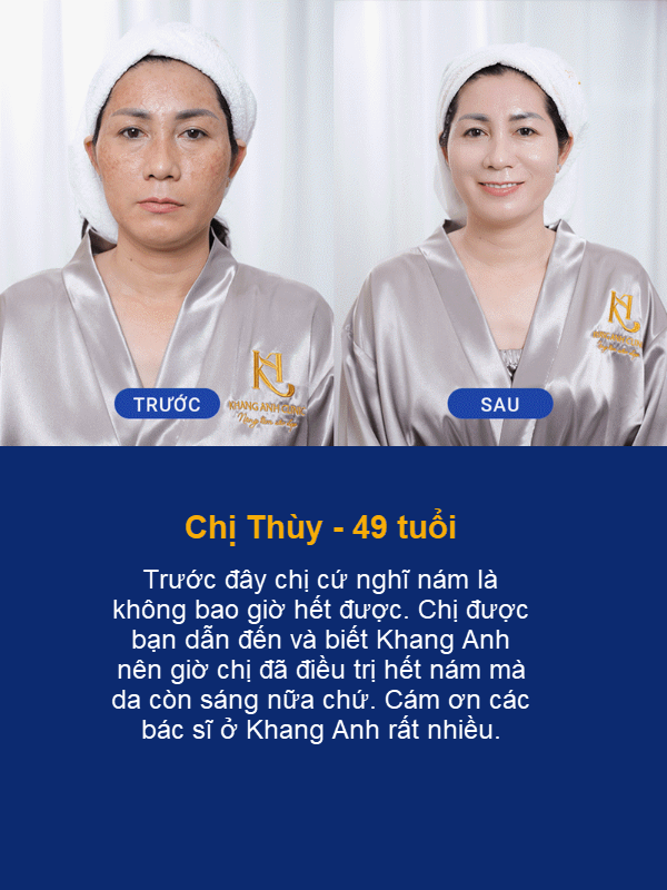 Chi Thuy 49 tuoi