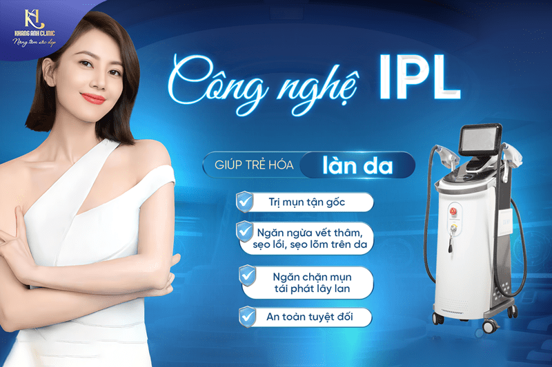 Cong nghe IPL 2