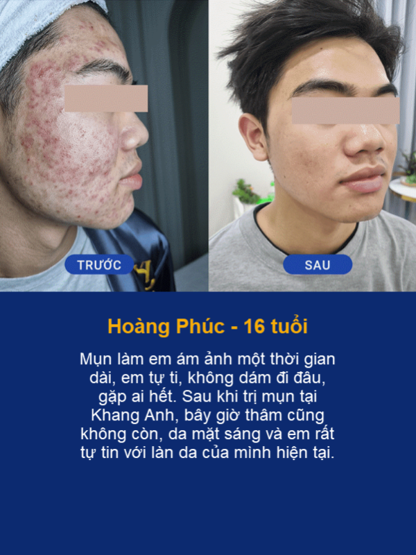 Hoang Phuc 16 tuoi