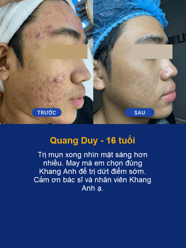 Quang Duy 16 tuoi